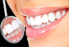 Photo for Magic Smile