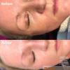 Photo for What is meant by Peeling skin? How to prevent it?