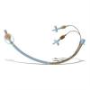 Photo for Anesthesia Endotracheal Tube Market Opportunities in Upcoming Years