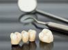 Photo for Global Dental Crown & Bridges Market: Global Industry Analysis and Forecast 2019-2025