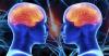 Photo for Neuroscience Market - Size, Share and Growth Analysis 2018-2026