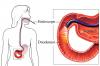 Photo for What is the Endoscopy Cost in India? - Credihealth