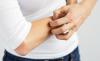 Photo for Pruritus Therapeutics Market Size Worth $17,275.12 Million by 2026
