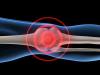 Photo for Synovial Sarcoma Treatment Market Top Key Players, Growth, Competitive Landscape and Forecast till 2026