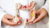 Photo for Irritable Bowel Syndrome Treatment Market Rising Globally with Top Players