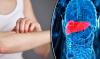 Photo for Breast Cancer Therapeutics Market Factors That Can Have A Sizable Impact On Industry Growth