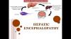 Photo for Hepatic Encephalopathy Market - Size, Share, Outlook, and Opportunity Analysis, 2019- 2027