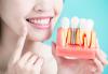 Photo for Dental Implants Market- Trend, Analysis and Forecast till 2026