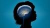 Photo for Autism Disorder Treatment Market -  Trends, Outlook, and Opportunity Analysis, 2018-2026