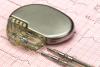 Photo for Pacemaker Surgery Cost In Kolkata - Credihealth