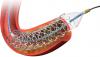 Photo for Cardiovascular Stents Market — Global Industry Insights, Trends, Size, Share, Outlook, and Opportunity Analysis, 2018-2026