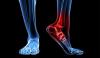 Photo for Podiatrist Miami, FL