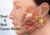 Photo for Head and Neck Cancer Market Symptoms and Signs Analysis 2026