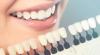 Photo for Cosmetic Implants Market 2026 - Onset of Advanced Technologies to Upsurge the Market Growth
