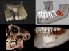 Photo for CBCT Dental Imaging Market Report Segmented By Type Of Detector, Application And Geography To 2025
