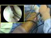 Photo for Orthopaedic Reconstruction Market Report 2018 - History, Present and Future Forecast
