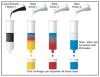Photo for High Performance Liquid Chromatography Market Report - Industry Size, Share, Trends, Growth And Forecast Till 2025