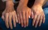 Photo for Hereditary Angioedema Market, by Drug Class, Distribution Channel, and Region - Global Trends and Forecast till 2025