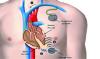 Photo for Cardiac Pacemaker Market Study By Type, Technology & Top Key Players - BIOTRONIK SE & Co. KG, Boston Scientific Corp., Cook Medical Inc., MEDICO S.p.A., Medtronic