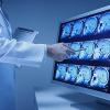 Photo for Global Neurothrombectomy Devices Market Growth Opportunities, Industry Analysis, Geographic Segmentation and Competitive Landscape Report to 2024