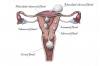 Photo for Uterine Cancer Drugs Market Exhibits Higher Growth Prospects during 2018-2026