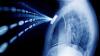 Photo for Implantable Medical Devices Market to Reach US$ 148.8 Billion by 2024