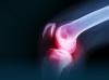 Photo for Best Rheumatologist in Kolkata - Credihealth