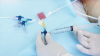 Photo for Liquid Injection Molding Market Research Report, 2026