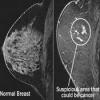 Photo for Global Breast Imaging Market Growth Opportunities, Industry Analysis, Geographic Segmentation and Competitive Landscape Report to 2024