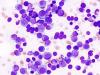 Photo for Multiple Myeloma Drugs Market Present Chances, Trends, Value Chain And Stakeholder Analysis 2018-2026