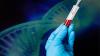 Photo for Hemophilia Gene Therapy Market Growth Analysis By BioMarin Pharmaceuticals, Inc., Spark Therapeutics, Pfizer, Inc.