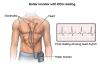 Photo for Holter Monitor Market Forecast To 2026 Based On Market Data Of The Period 2018-2026