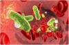 Photo for Sepsis Diagnostic Market Predicted to Grow at a Moderate Pace Through 2026