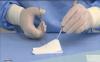Photo for Hemostasis & Tissue Sealing Agents Market - Global Industry Insights and Forecast to 2025