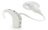 Photo for Binaural Cochlear Implant Market - Size, Share, Outlook, and Opportunity Analysis 2018 – 2026