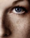 Photo for Know Your Skin: The Difference Between Hyperpigmentation and Melasma