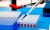 Photo for Enzyme-Linked Immunosorbent Assay Market Growth & Estimation, 2025 | Accolade Wines, Amvyx S.A., Bacardi Limited, Castel Group, Constellation Brands Inc., Davide Campari-Milano S.p.A.