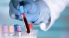 Photo for Non-Invasive Cancer Diagnostics Market Growing Automation in Healthcare to Benefit Growth of the Market