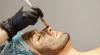 Photo for Pigmented Lesion Treatment Market – Dynamic Business Environment during 2018 – 2026