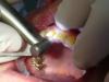 Photo for Electric Dental Handpiece Market Study By Type, Technology & Top Key Players - Dentamerica Inc., Dentflex, Dentsply International, Inc., Inovadent, Keystone Dental, Inc.