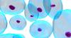 Photo for Virology Testing Market - Size, Share, Outlook, and Opportunity Analysis, 2018 – 2026