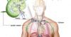 Photo for Hodgkin’s Lymphoma Treatment Market – Global Industry Insights, Trends, Outlook, and Opportunity Analysis, 2019 – 2027
