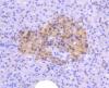 Photo for bcl10 antibody