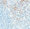 Photo for cd42b antibody