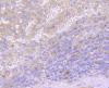 Photo for b burgdorferi antibodies