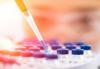 Photo for Lyophilization Services for Biopharmaceuticals Market Size, Share, and Outlook, 2019-2027