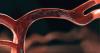 Photo for Thrombectomy Devices Market Sales Price and Sales Revenue Analysis by Top Key Players