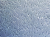 Photo for Mesenchymal Stem Cells Market Anticipates Steady Growth Till 2026