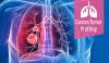 Photo for Cancer/Tumor Profiling Market Trends, Outlook, and Opportunity Analysis, 2018–2026