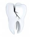 Photo for Same Day Teeth Cleaning